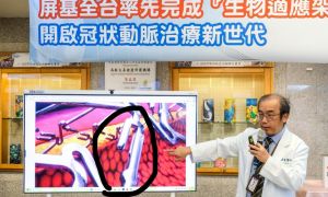 屏基率先全台完成「生物適應架」植入！三個月內已累積完成24例